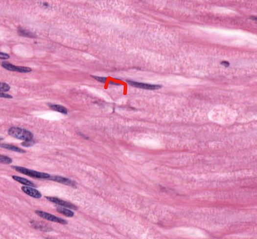 <p>(structure)</p>
