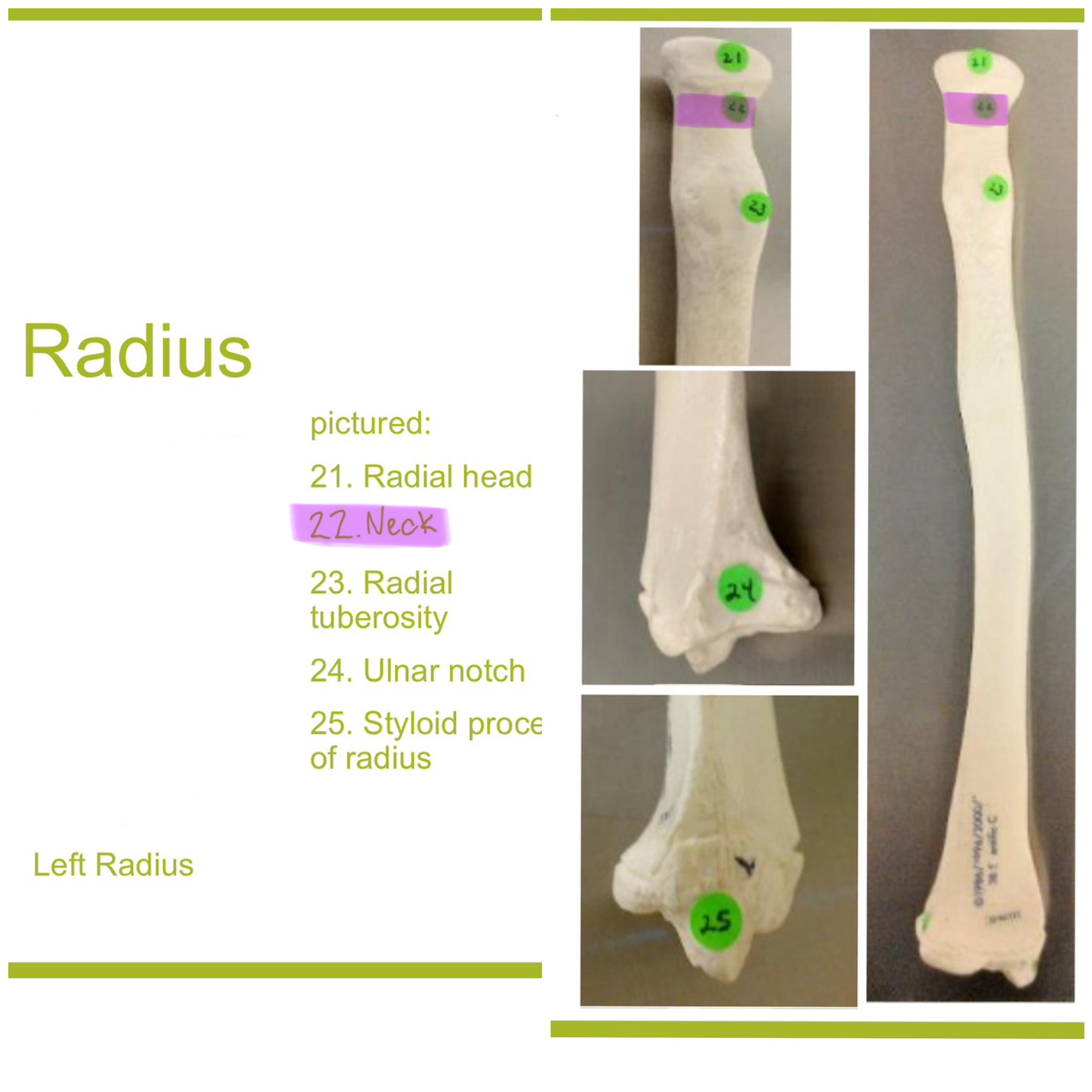 <p>neck of radius</p>