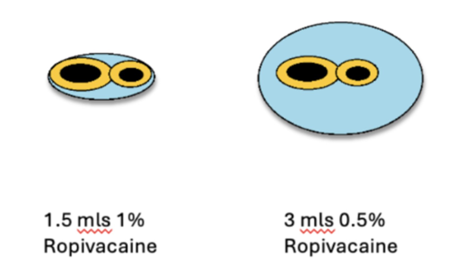 <p>- Sufficient volume (need to get good coverage of nerves)</p>
