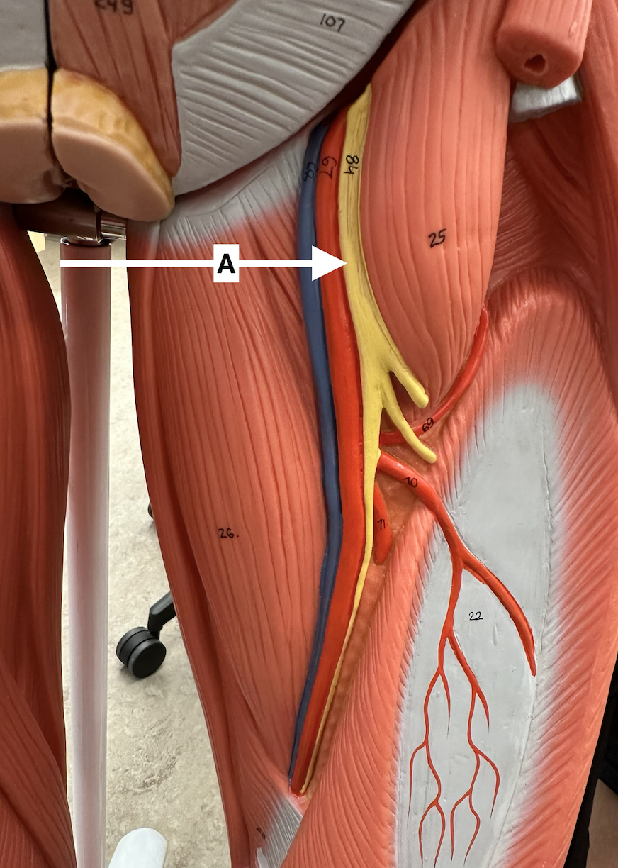 <p>Name point A.</p>