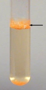 <p>what is that “skin” that develops on the surface of a broth media and is evidence of growth called? see picture to the right</p><p>a. turbidity </p><p>b. flocculant growth</p><p>c. pigmentation </p><p>d. a pellicle </p>