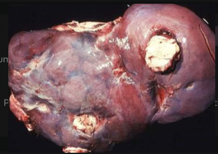 <p>suppurative lesions in cows, sheep and pigs </p>