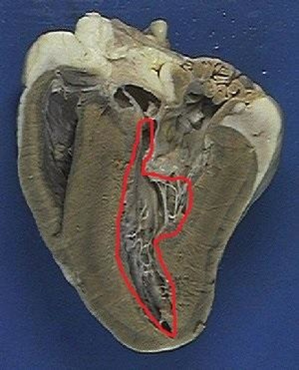 <p>The chamber of the heart that pumps oxygenated blood to the rest of the body through the aorta.</p>