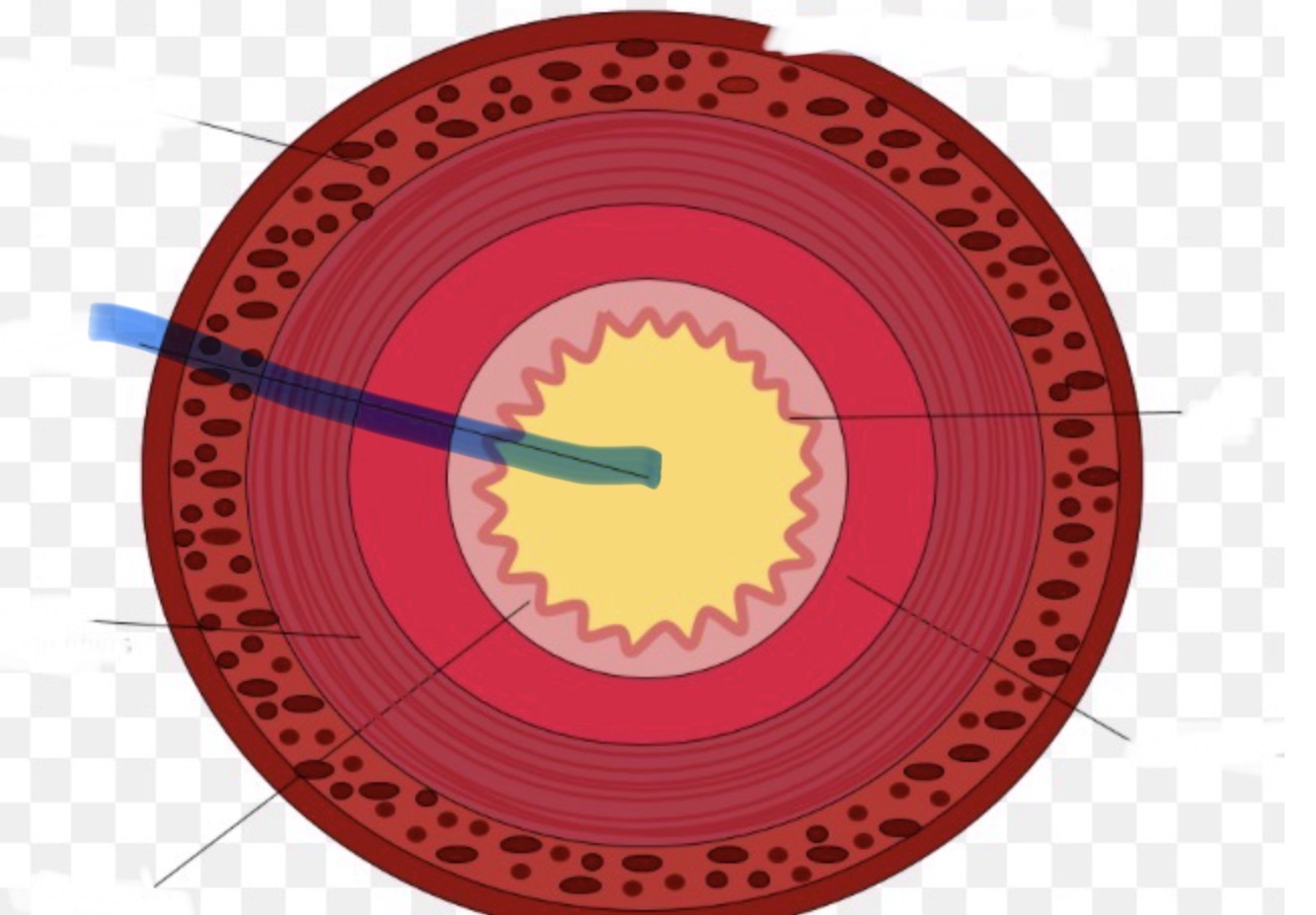 <p>Welk deel van de doorsneden vd dunne darm is hier aangeduid</p>
