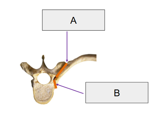 <p>B</p>