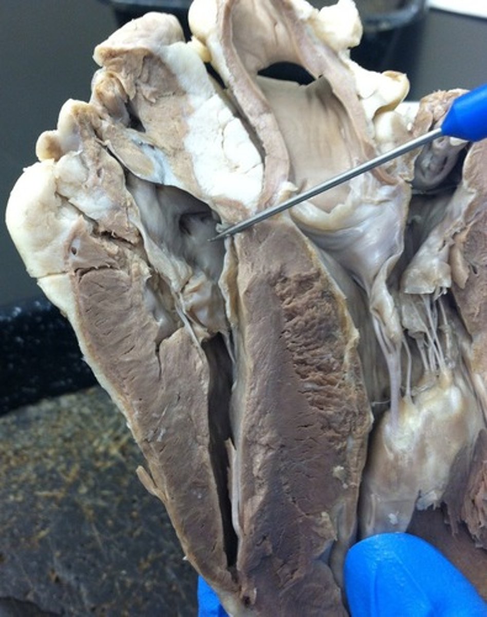 <p>Identify this space within the auricle</p>