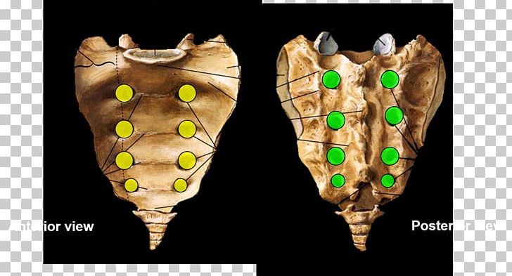 <p>Sacrum Location: (Plural)</p>