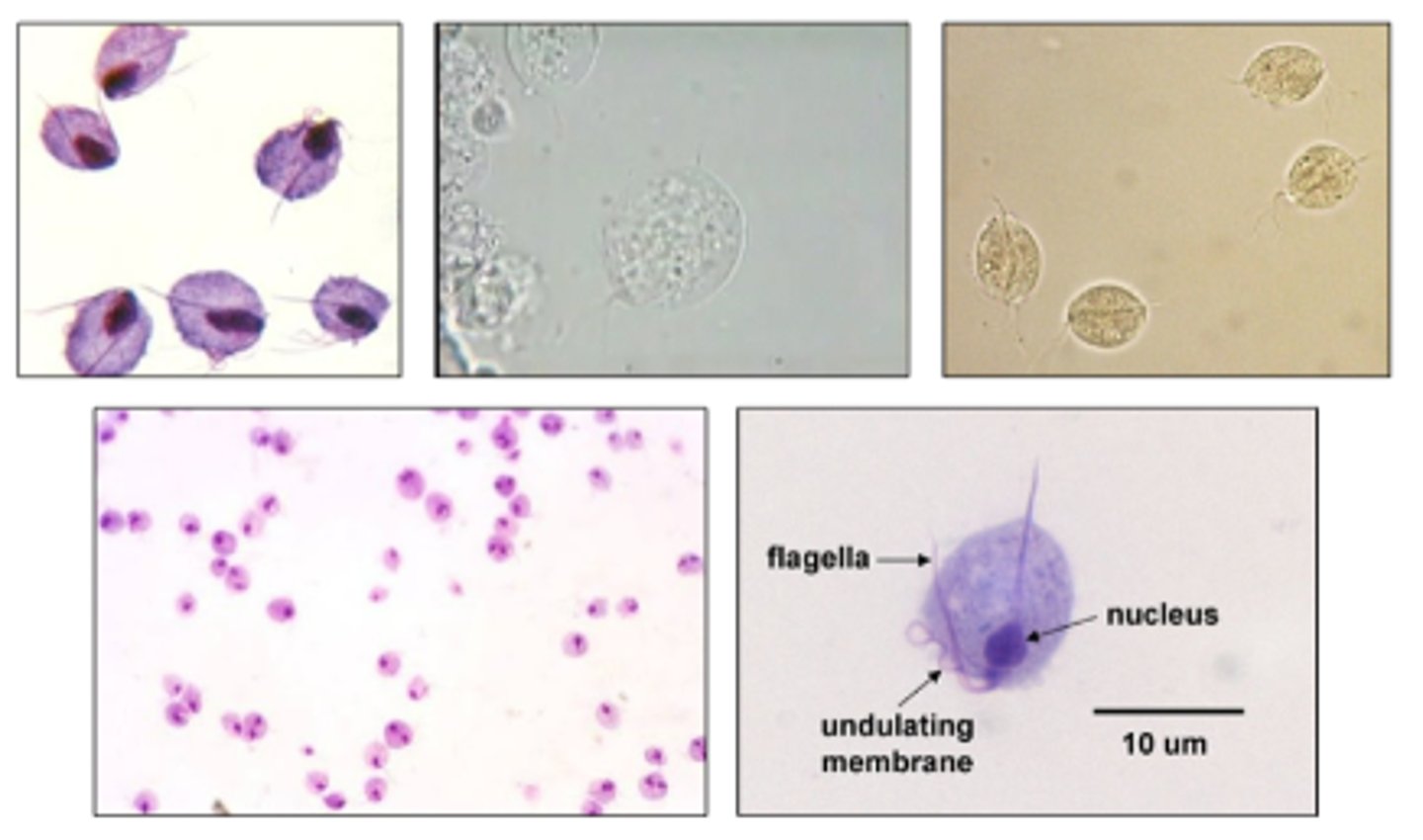 <p>What is the LINEAGE of the organism pictured?</p>