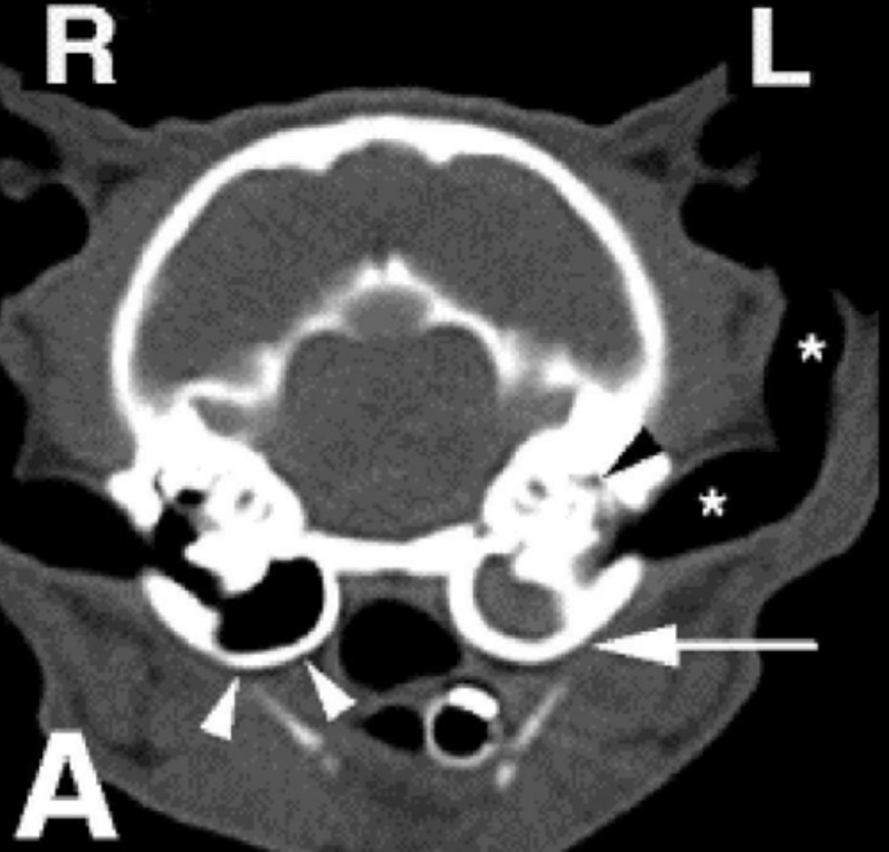 <p>What are the top differential diagnoses for this image?</p>