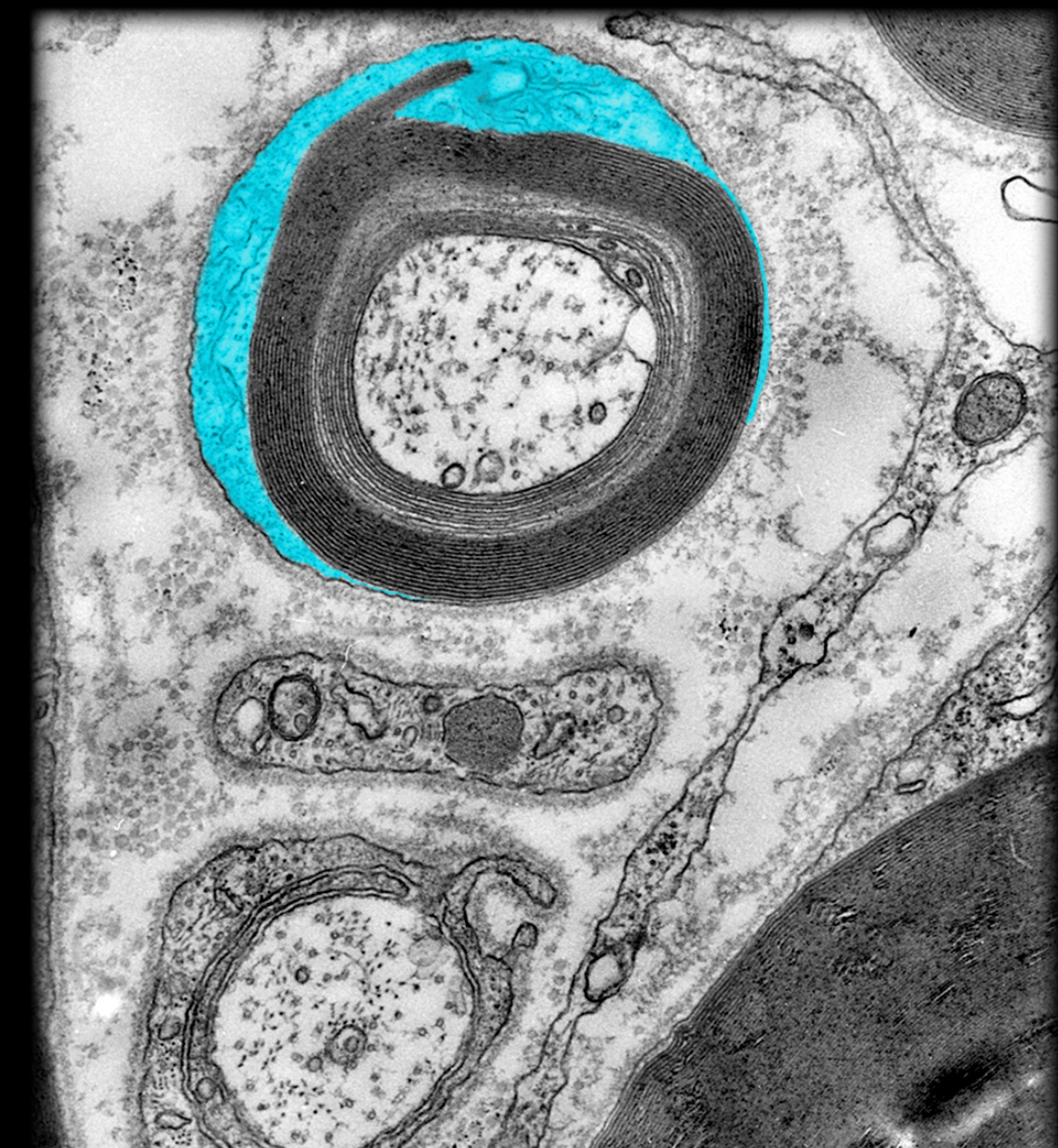 <h4 collapsed="false" seolevelmigrated="true"><strong>Location:</strong></h4><ul><li><p>Schwann cell (soma and outermost layer of myelin sheath)</p></li></ul><h4 collapsed="false" seolevelmigrated="true"><strong>Description:</strong></h4><ul><li><p>Amorphous substance between plasma membrane and nuclear membrane</p></li><li><p>Contains nucleus and other organelles</p></li><li><p>Contains cytoskeleton, enzymes, nutrients, and other proteins</p></li></ul><h4 collapsed="false" seolevelmigrated="true"><strong>Also known as:</strong></h4><ul><li><p>Cytoplasm also known as cytosol</p></li></ul><h4 collapsed="false" seolevelmigrated="true"><strong>Comment:</strong></h4><ul><li><p>Inner layers of myelin sheath lack cytoplasm</p></li></ul>