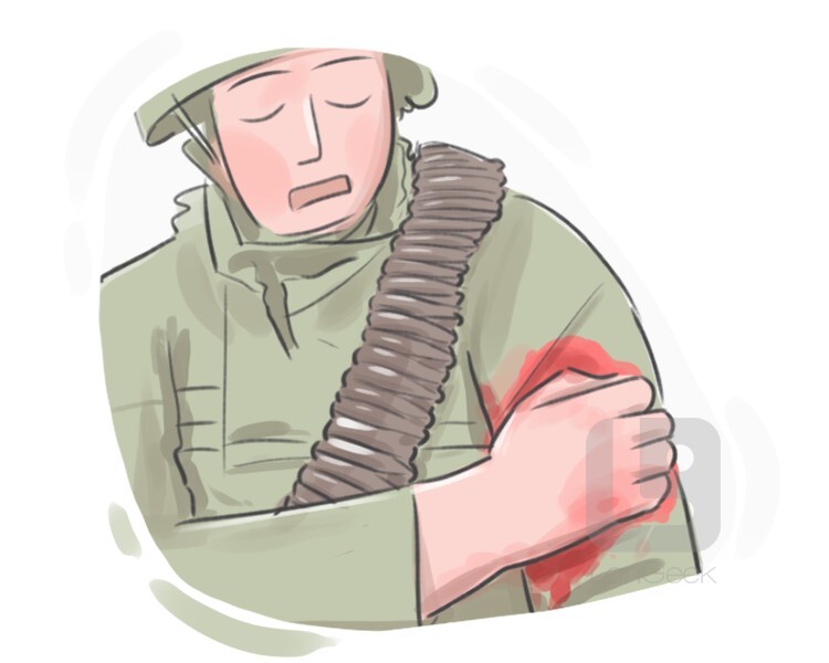 <p><span><span>injured/wounded</span></span></p>