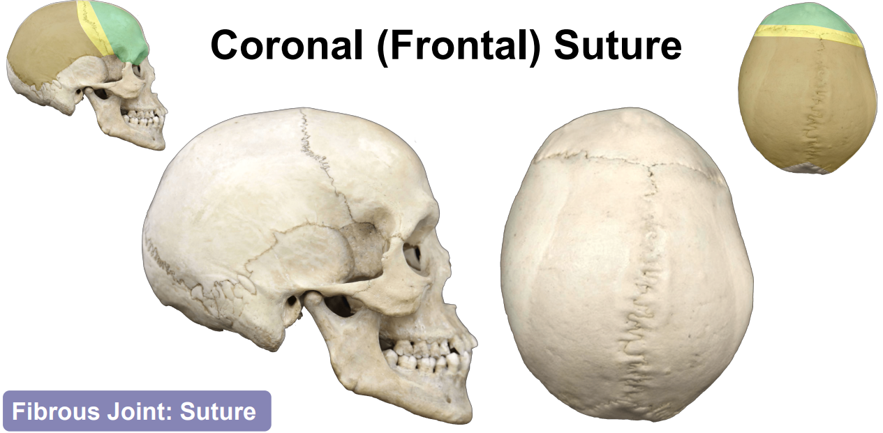 <p>Fibrous Joint: Suture</p><p>Joint specific to the skull where bones are close together and joined by sutural ligaments</p>