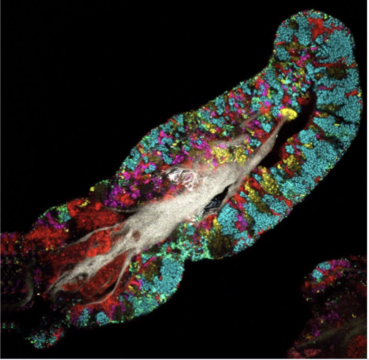 <p>Microbiome is the microorganisms in a particular environment</p><p>-up to 90% of all disease can be reached in some way back to the gut and health of microbiome, as there are 3.3 million non-redundant genes in the human gut microbiome (the genes in our microbiome outnumber the genes in our genome by ab 100 to 1); even the human tongue has a complex microbiome essential for digestion, immunity, and oral health</p>