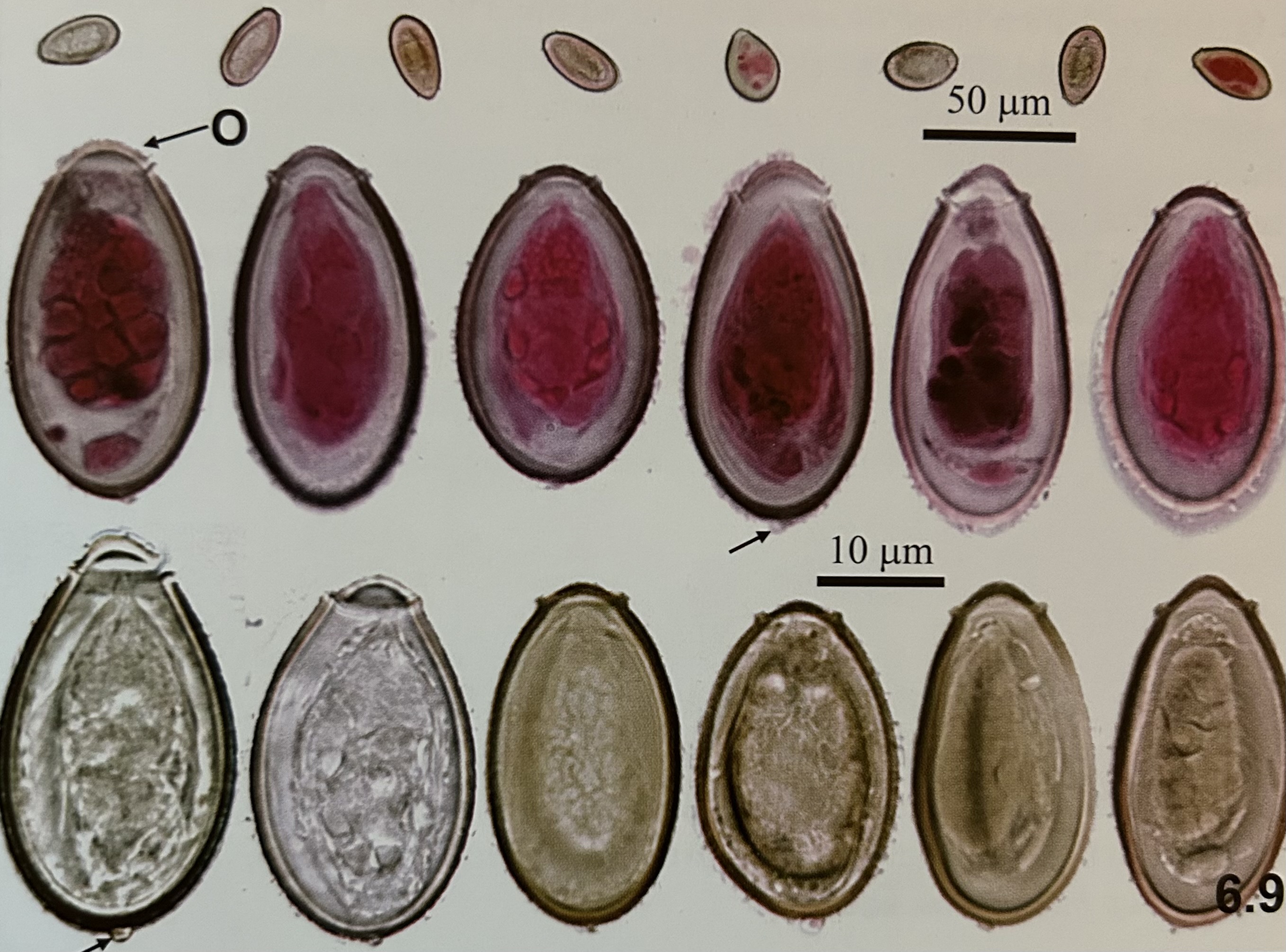 <p>structures of Chlonorchis sinensis (egg)?</p>
