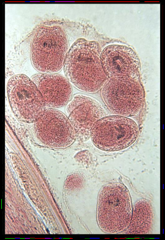 <p><strong>Name the parasitic stage.</strong></p><p><strong>Mention special characteristics of the stage.</strong></p><p><strong>Name the intradermal test used for diagnosis of this disease.</strong></p><p><strong>What is the definitive diagnostic method?</strong></p>