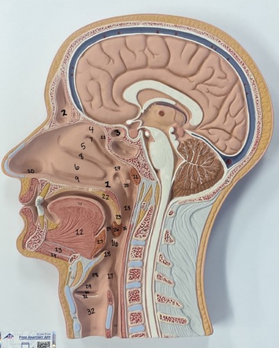 <p>What is structure 4?</p>