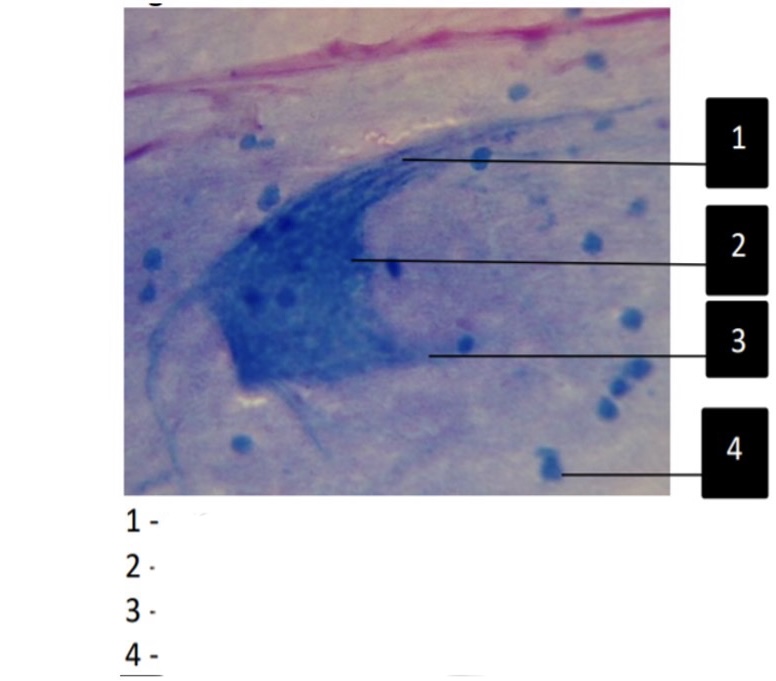 <p>Label all terms </p>