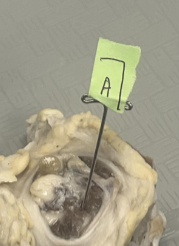 <p>What does Label A represent?</p>