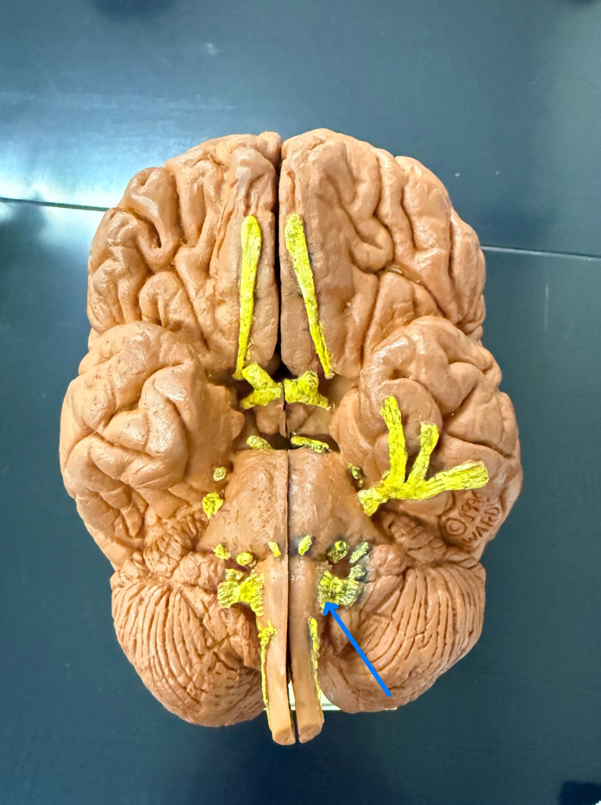 <p>Name the cranial nerve on the brain model</p>