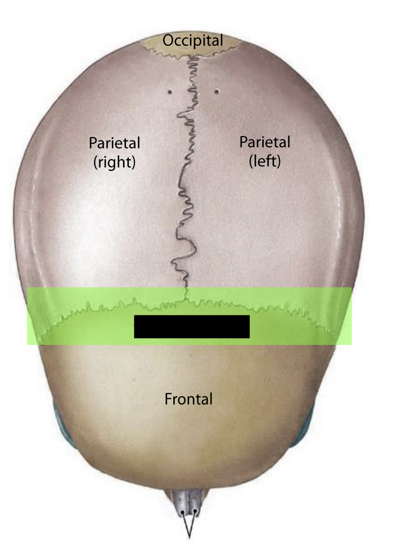 What suture is this?