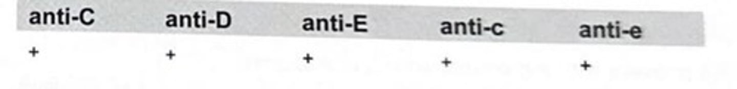 <p>A patient's red cells type as shown in the table. Which is the most probable genotype?</p><p>a R1R1</p><p>b R1r'</p><p>c R0r"</p><p>d R1R2</p>