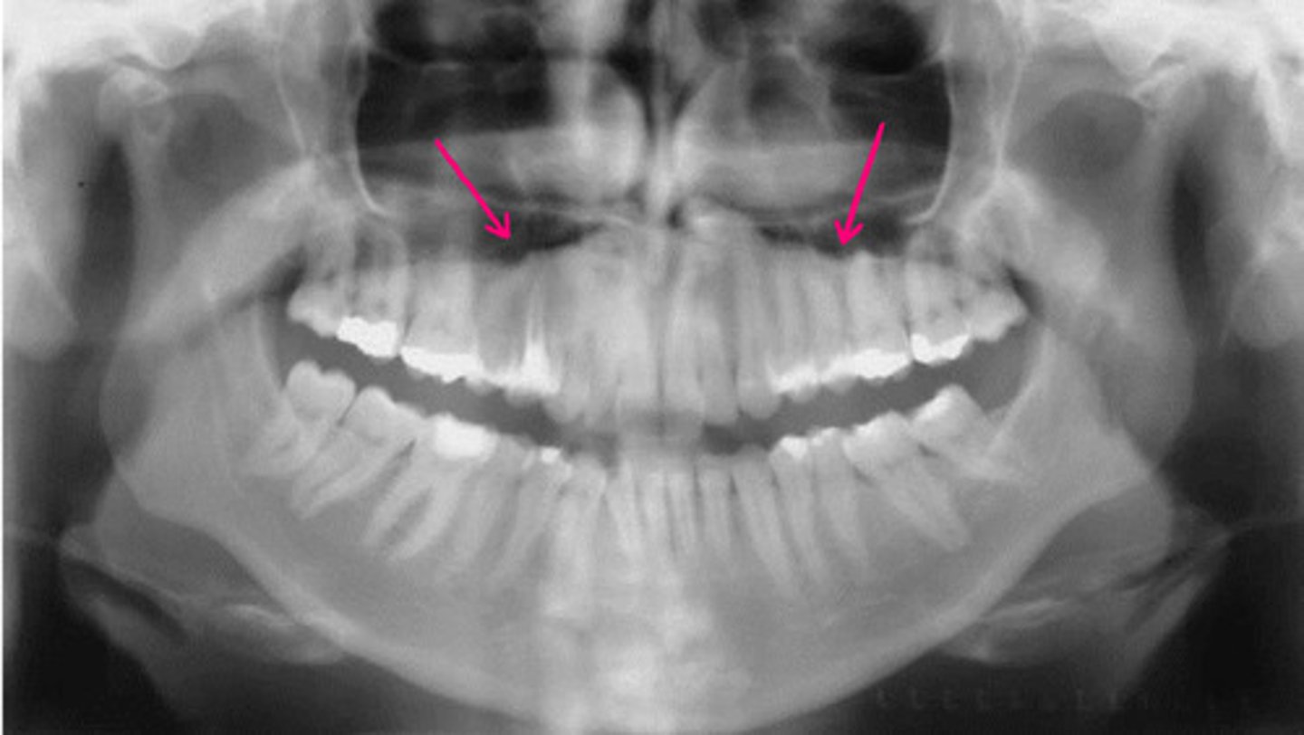 <p>Identify the structure.</p>