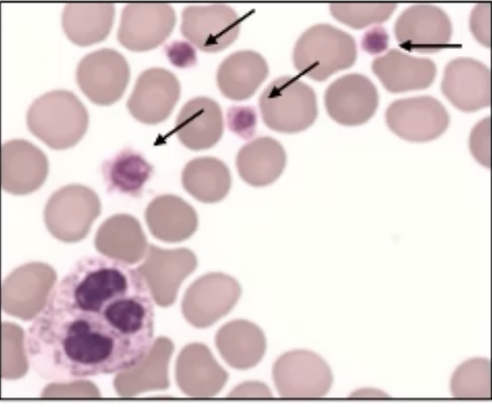 <p>What are the arrows pointing at in this image? </p>