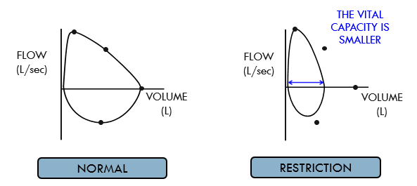 <p>normal peak expiratory flow </p><p>no scooping out of the expiratory limb </p><p>dec in vital capacity </p>