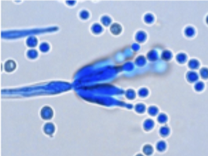 <p>branching, thread-like filaments called hyphae form a tangled mass called mycelium</p>