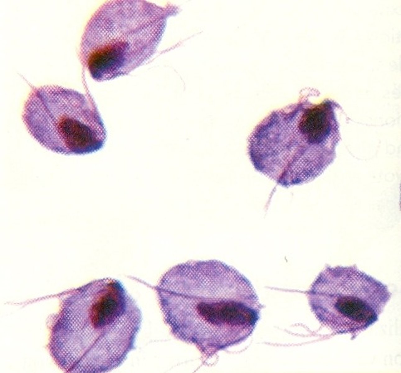 <p>What is this Protozoa</p>