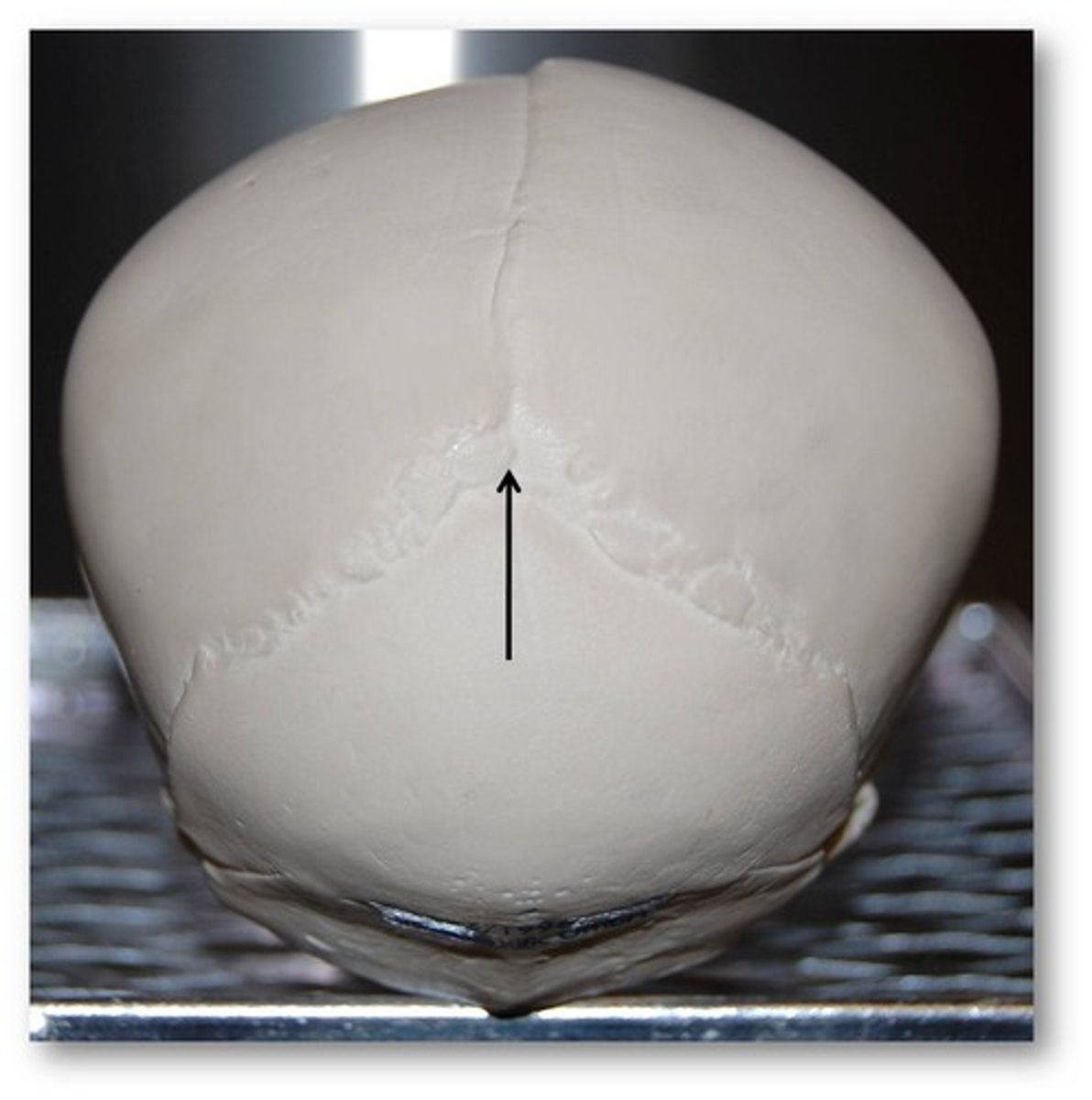 <p>back of the head</p>