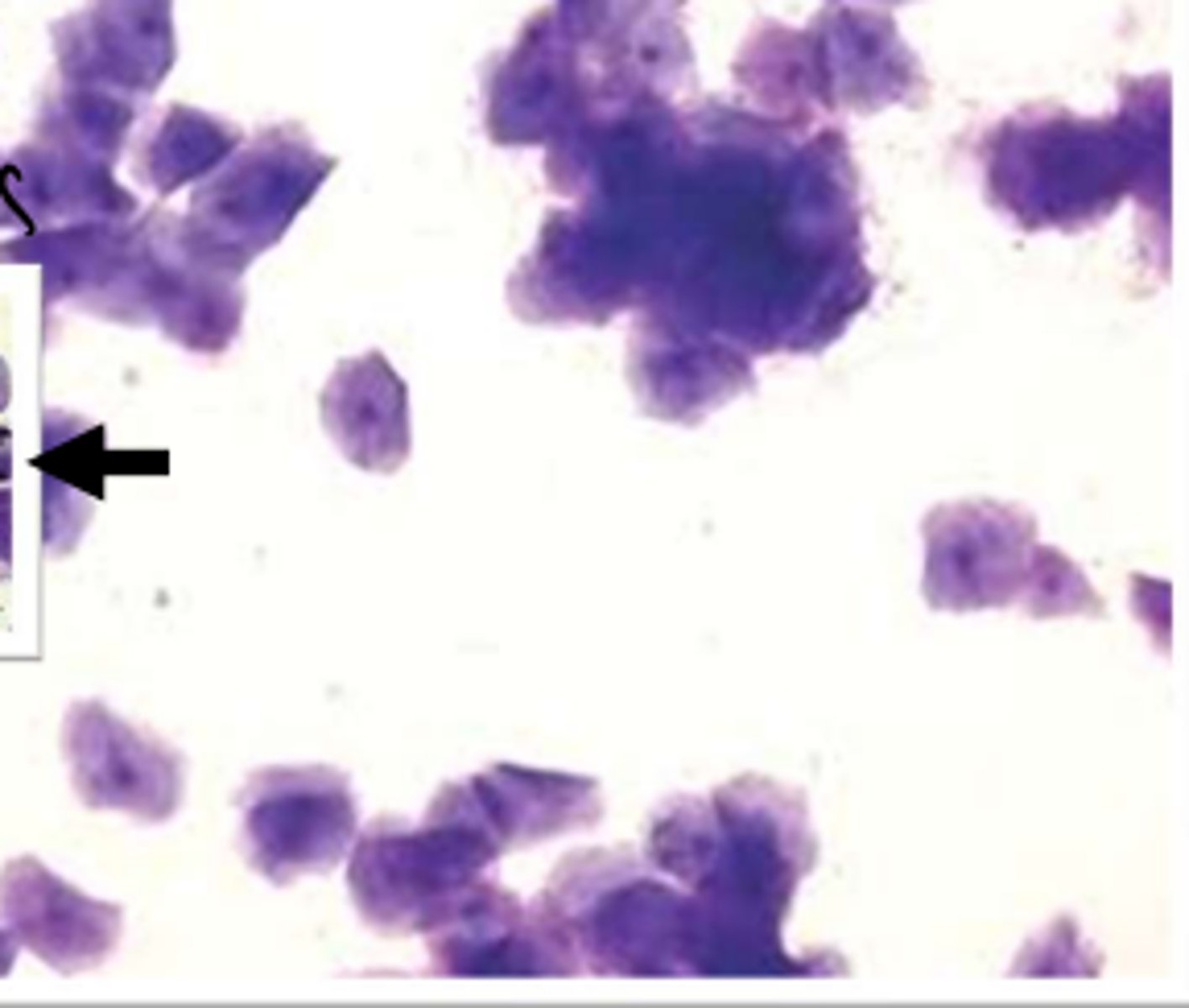 <p>predominant cell type = superficial cells and large intermediate cells over 80-90% </p><p>drop in estrogen reduces diapedesis of RBCs into vaginal lumen = no to minimal RBCs, cellular debris, and mucus </p><p>late in stage = large sheets/rafts of superficial cells </p>