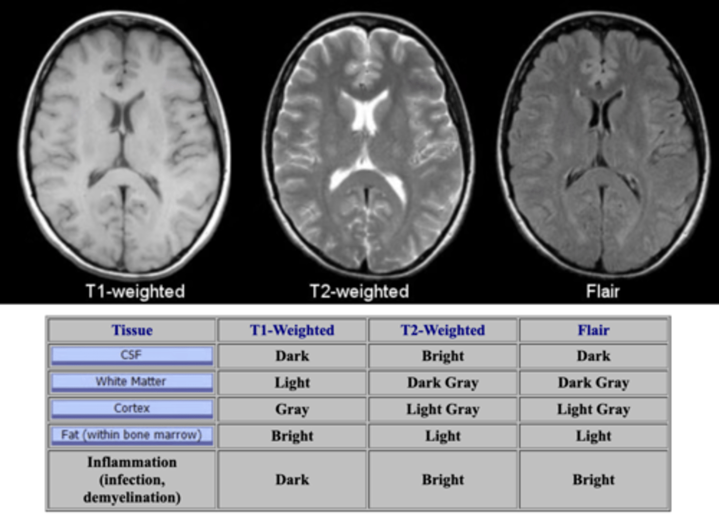 <p>Q: fat is bright under this MRI</p>