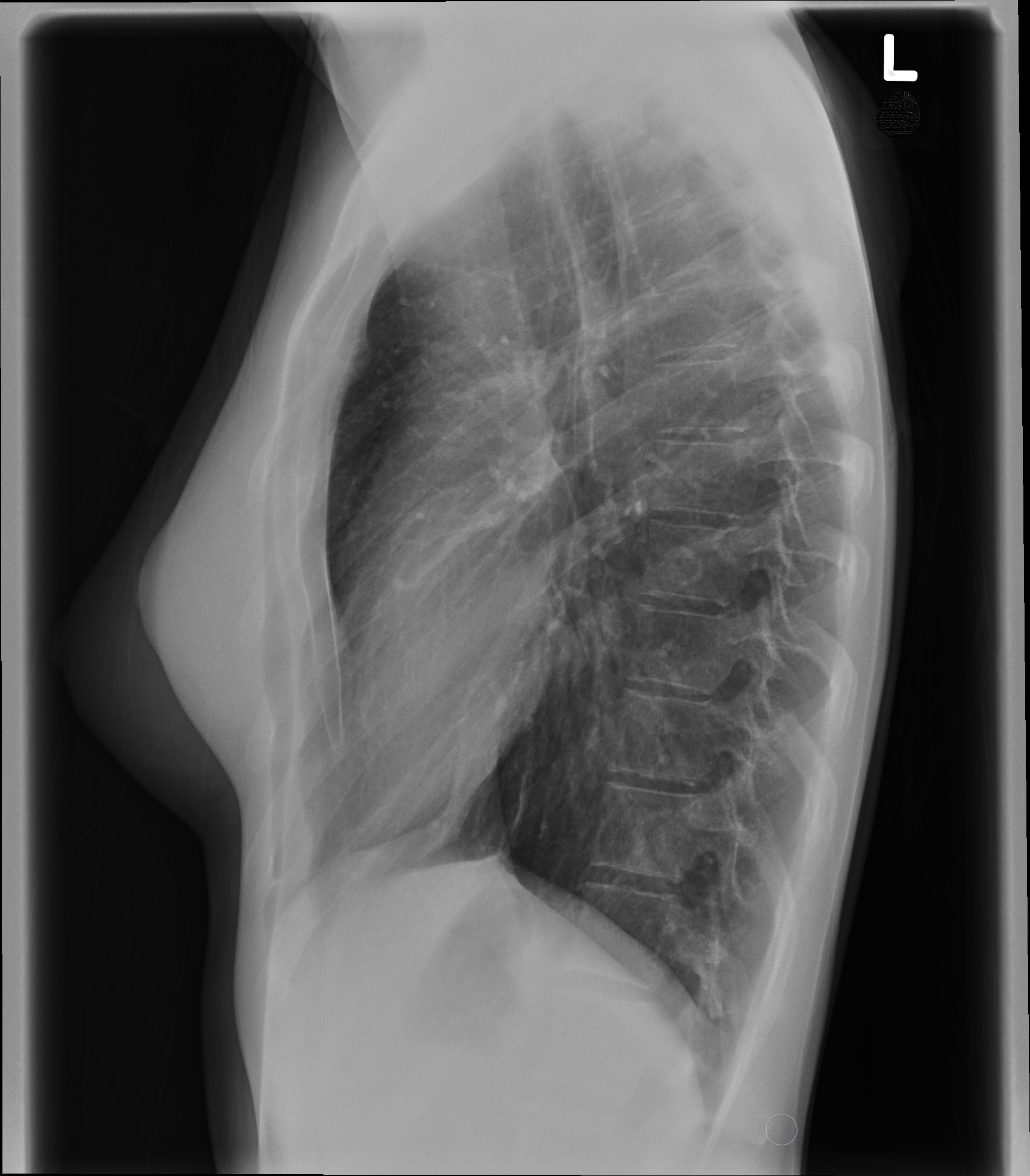 <p>Below the T11 vertebra.</p>