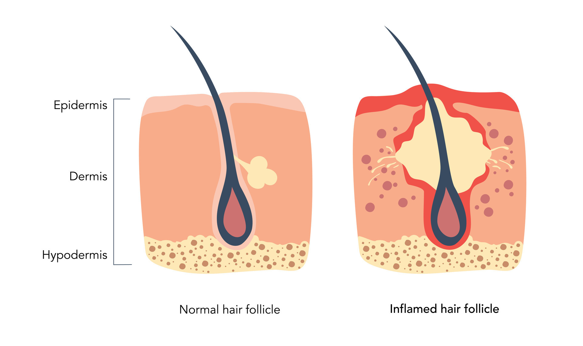 <p>hair follicle </p>