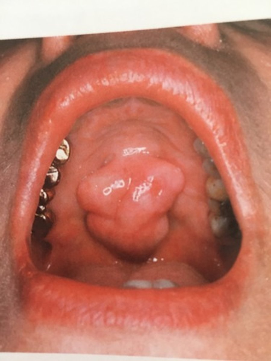 <p>-a segment or lobe that is part of a whole</p><p>-can be fused together</p>