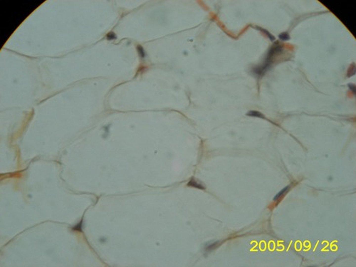 <p>Cushioning of organs, insulation, and energy storage are three functions of ___________.</p>