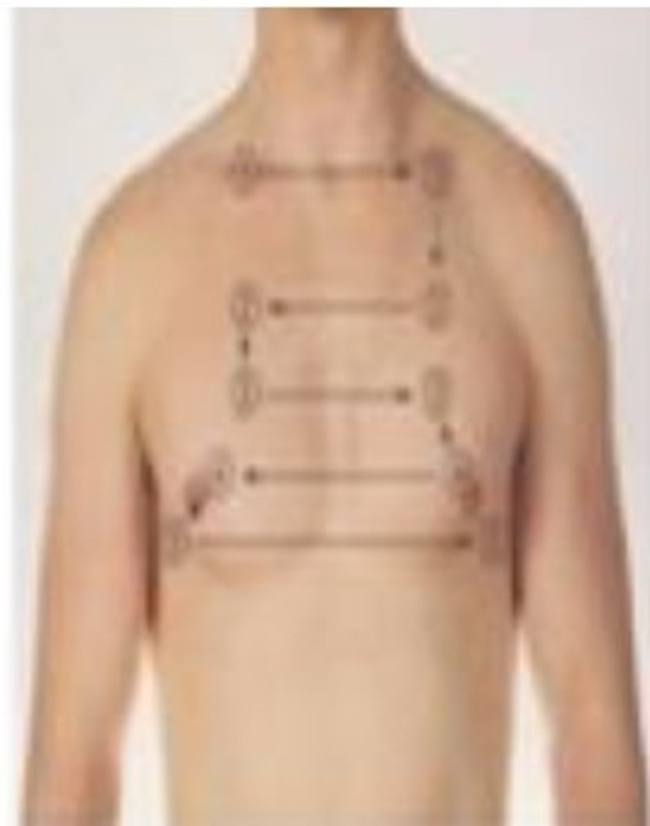 <p>A. Vesicular sounds</p><p>Tracheal: heard over trachea</p><p>Bronchial: heard in large airways in anterior chest near 2nd and 4rd intercostal space</p><p>Broncho-vesicular: posterior chest between scapula</p><p>Vesicular - most lung fields</p>