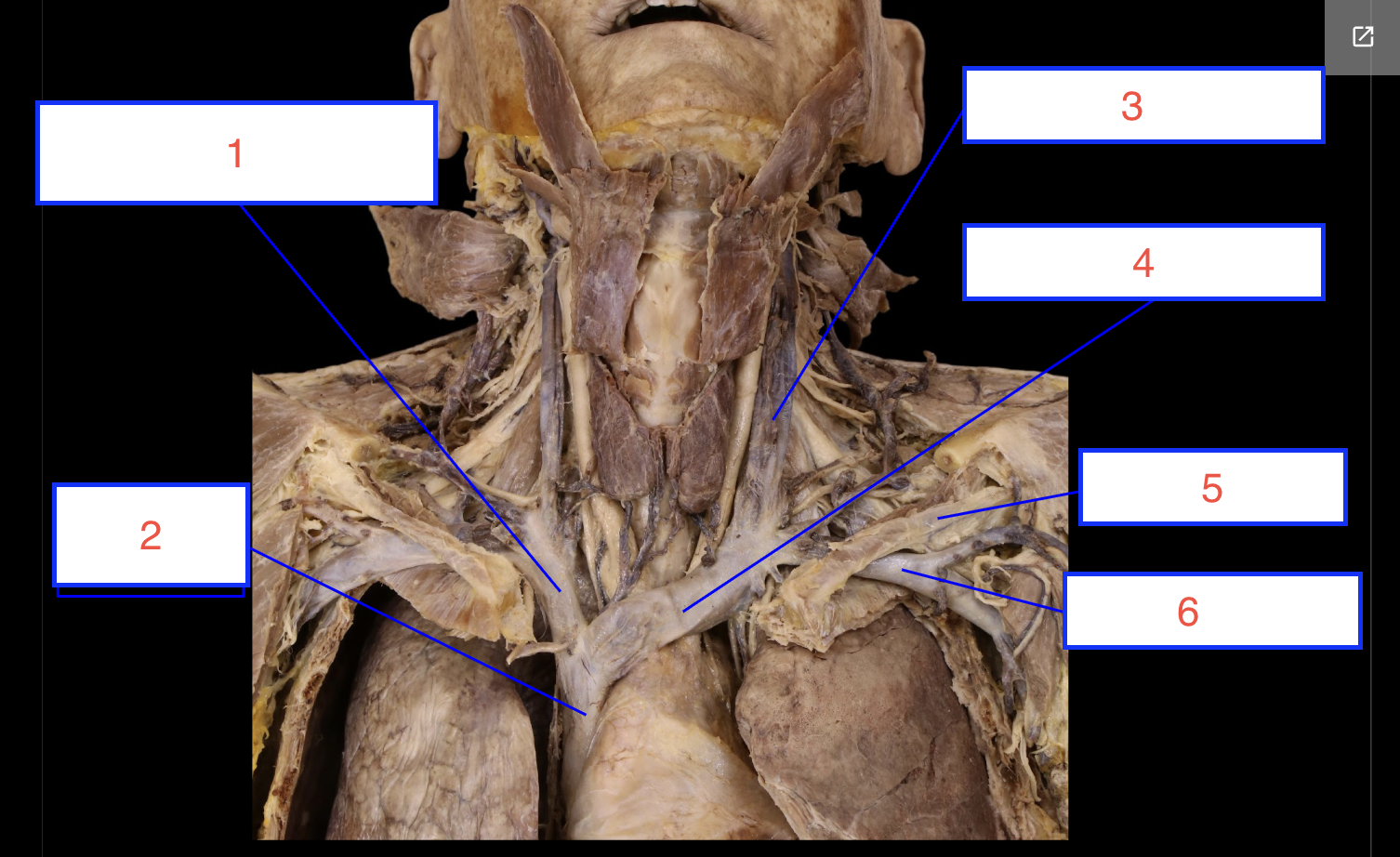 <p>3 (vein)</p>