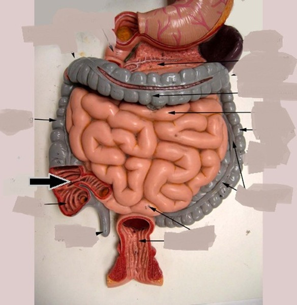 <p>Separates the ileum from the cecum</p>