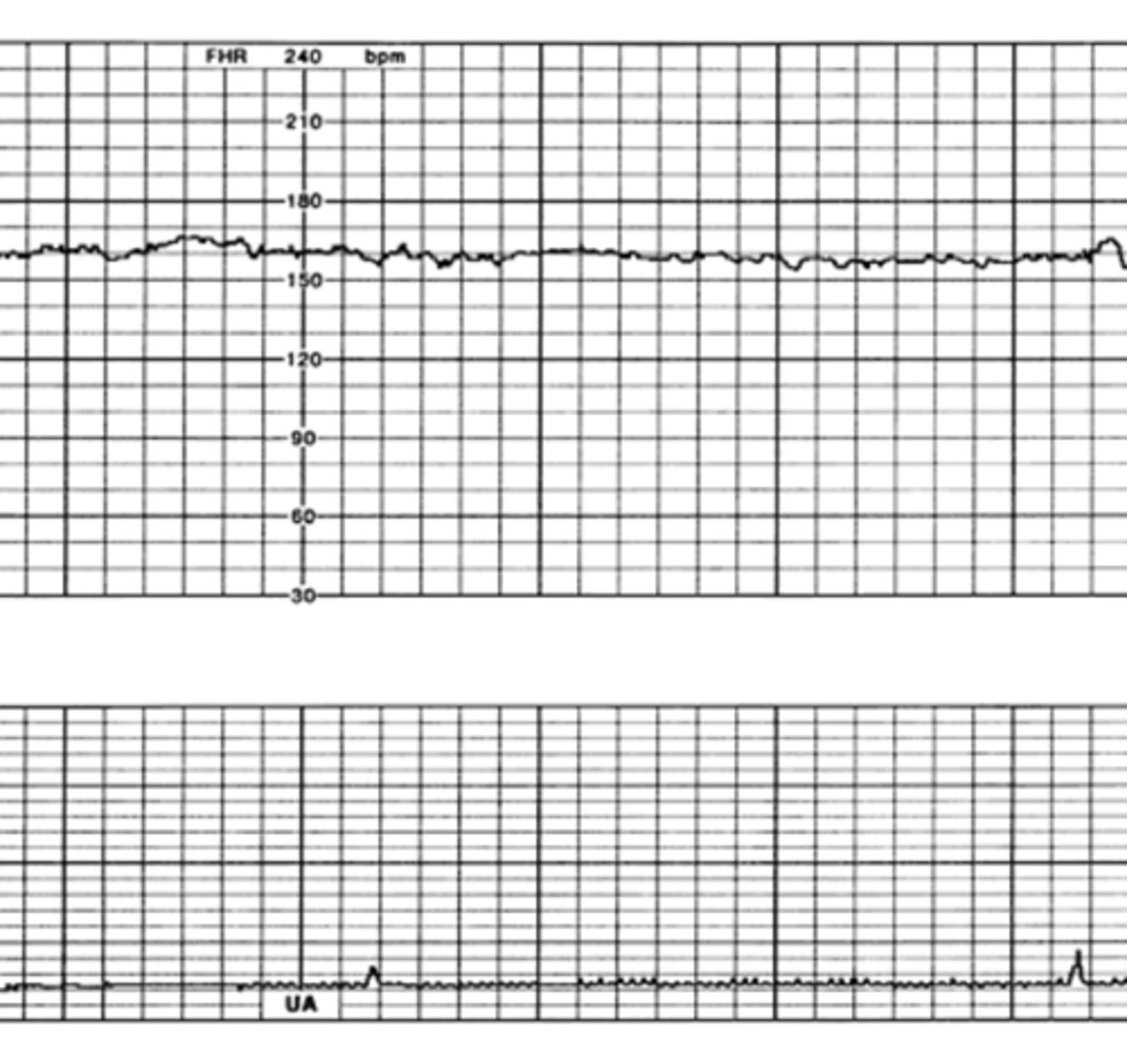 <p>How would you classify this variability?</p>