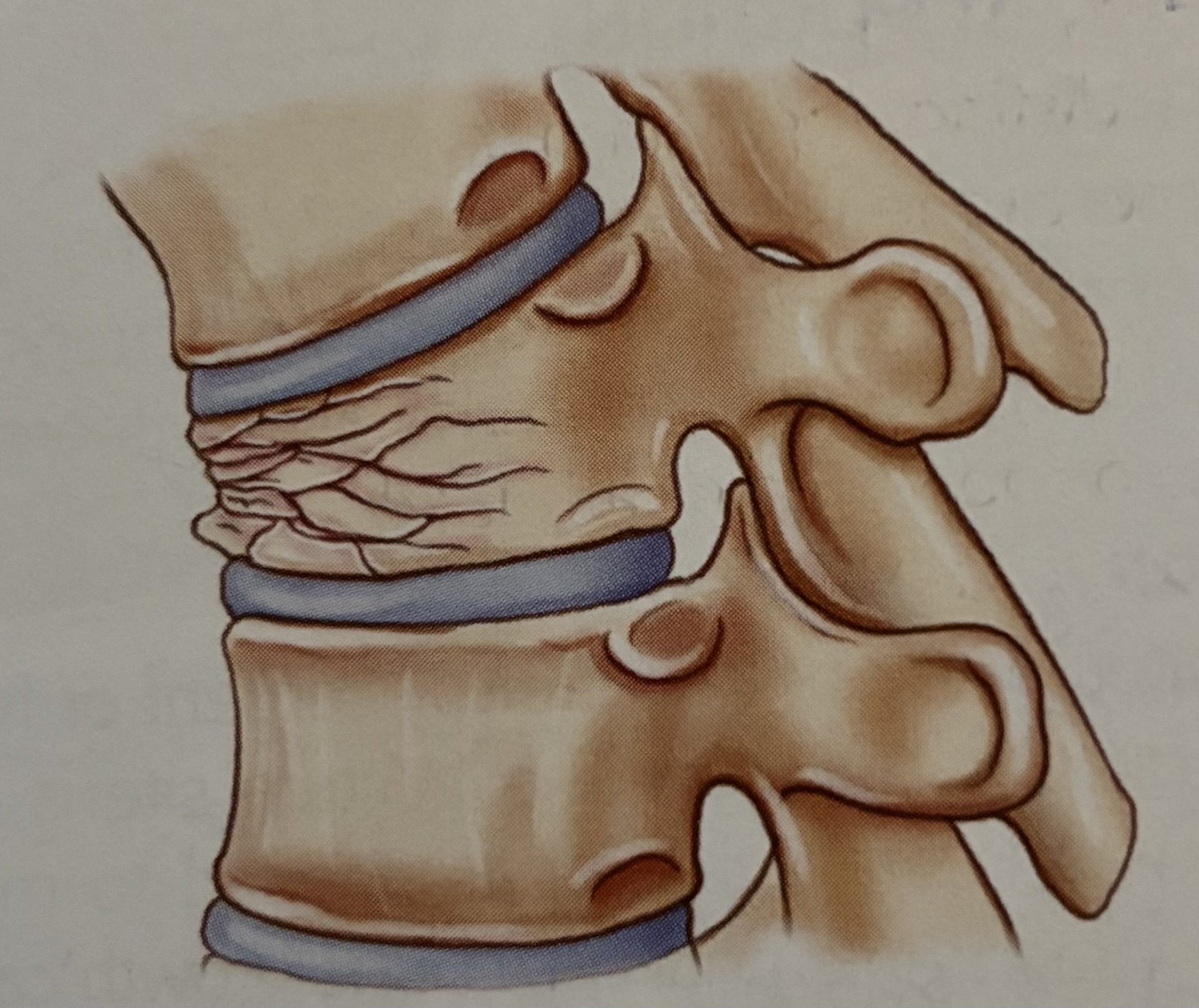 <p>What type of fracture is this?</p>
