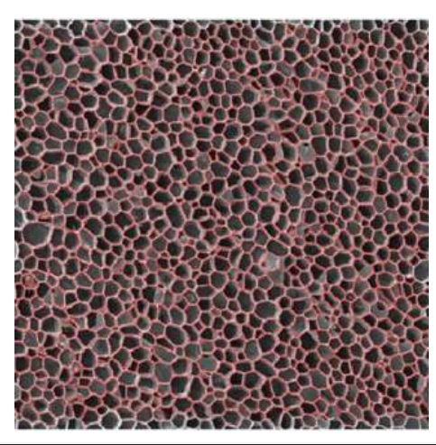 <ul><li><p>Forms to the outside of the cork cambium </p></li><li><p>Consists of dead cells when mature</p></li></ul><p></p>