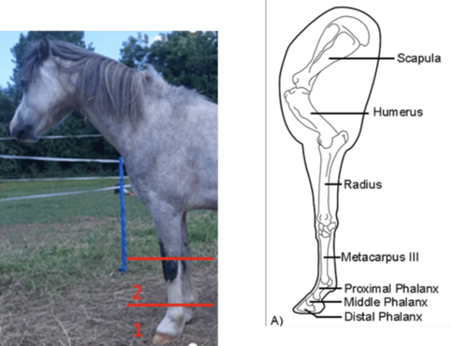<p>Distal radius to mid metacarpal region</p>