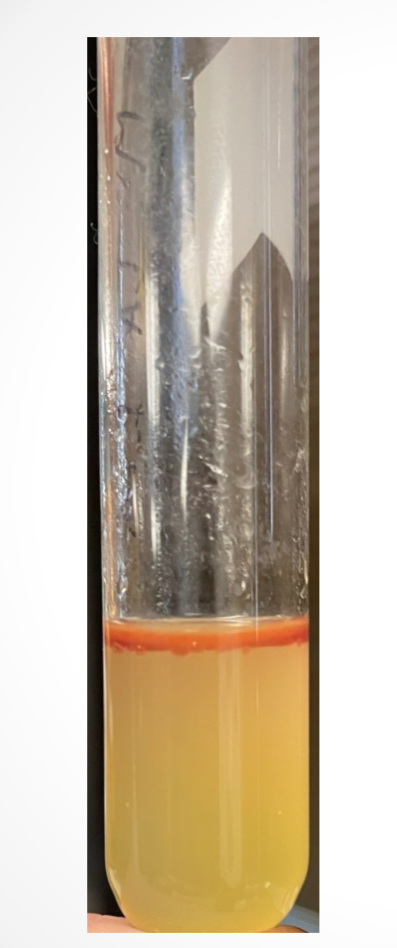 <p>What medium is used in this test? What bacteria was used and what does the reaction suggest?</p>