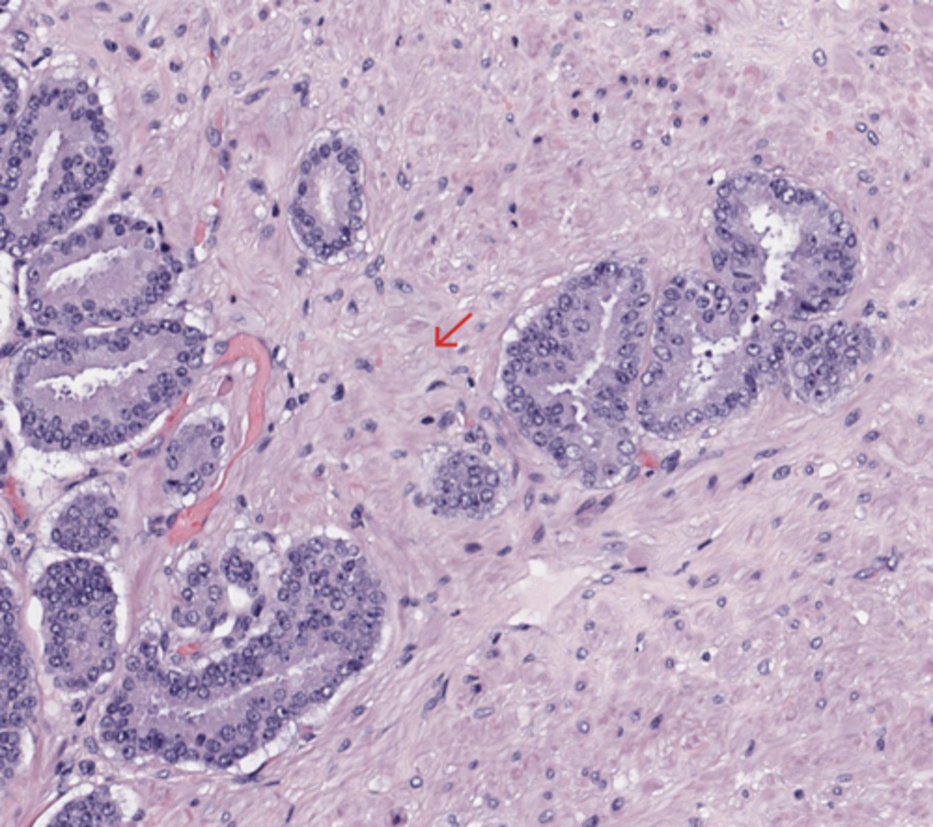 <p>Prostate</p>