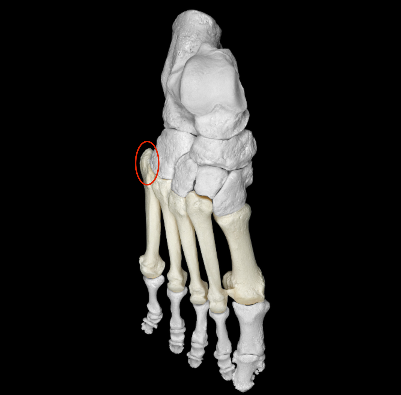 <p>on the base of metatarsal 5 that wraps cuboid </p>