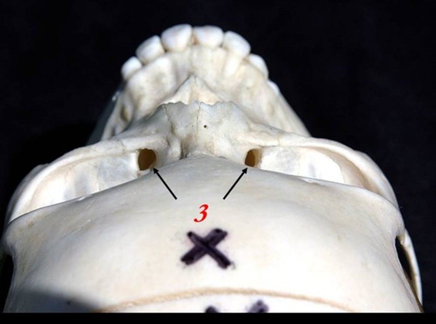 <p>What are the arrows at #3 pointing to?</p>