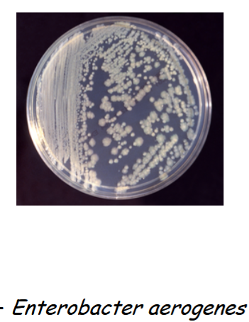 <p>ferments lactose (+). (pink colonies), gram negative</p>