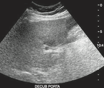 <p><span><strong>The hepatic pathology demonstrated in this sonogram most likely represents:<br></strong></span></p><p></p>